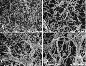 Mycelium, used to grow the mushroom tiny house, an example of housing innovations