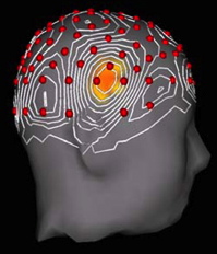 Brain map of increased gamma wave activity, measured by electroencephalography, during an aha moment like those from insight solutions in brain science research