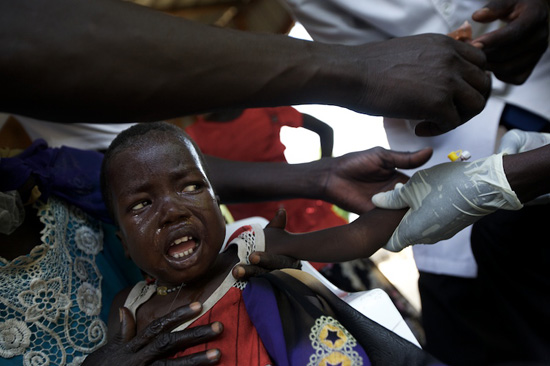 A boy in South Sudan is being tested for Kala-azar, life lessons in the spread of disease in developing countries via photojournalism (Photo © John Stanmeyer)